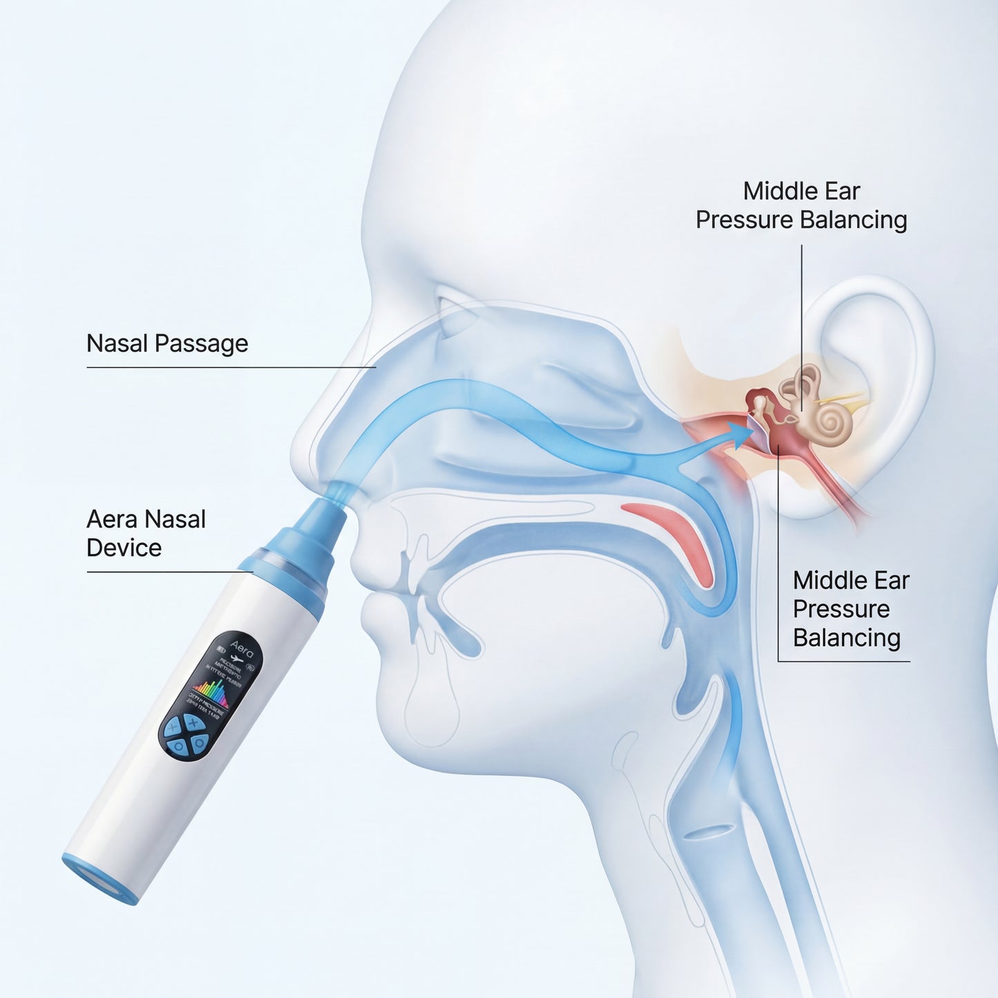 Aera — Flight Pressure Relief